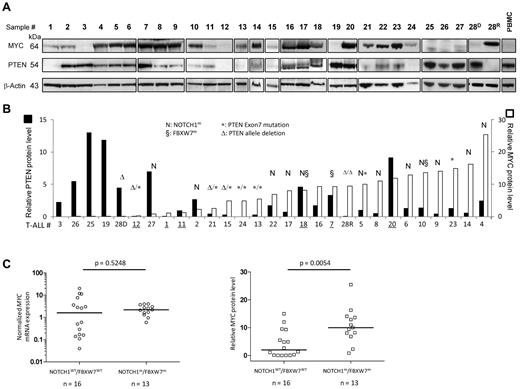 Figure 5. Western blot analysis of PTEN and MYC in primary T-ALL samples and cell lines. (A) Western blot analysis of PTEN and MYC in 29 primary T-ALL samples. The same immunoblots were used to probe MYC, β-actin and PTEN. (B) Quantification of the relative MYC and PTEN protein amount (see “Immunoblot analysis” for details). Samples were ranked according to increasing MYC protein abundance. (C) Relative MYC transcript levels (left) and relative MYC protein levels (right) of the 29 T-ALL subset used for proteomic analysis were plotted according to NOTCH1/FBXW7 status and analyzed using nonparametric Mann-Whitney test.