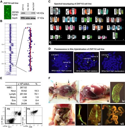 Figure 2. Characterization of the ZNF112 cell line. (A) Fluorescence microscopy shows that all ZNF112 cells are GFP+ with stable expression (Western blot) of the ZMYM2-FGFR1 fusion protein. The murine pro-B-cell line BaF3 expressing ZMYM2-FGFR1 (BaF3-ZNF) was used as a positive control, and mesenteric lymph node cells (MLN) provide the negative control. (B) CGH array analysis of ZNF112 cells shows additional copies of chromosomes (Chr) 7, 10, 15, and loss of regions within 16qA1 and 14qC2. (C) Spectral karyotyping analysis confirmed the aCGH profiles for ZNF112 cells and also shows loss of the Y chromosome and an additional unidentified marker chromosome (M). (D) FISH using RP23 BAC clones identifies the 16;Y translocation (see text). (E) Leukemias resulting from syngeneic grafts of ZNF112 cells into mice without irradiation show high numbers of white blood cells that are Gr1+ and Mac1+ (F). Mice with ZNF112 grafts show hepatosplenomegaly and enlarged lymph nodes with GFP+ cells.