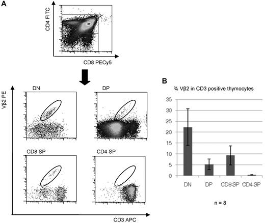 Figure 2. WT1 specific T cells are selected in the thymus. (A) FACS analysis of thymocytes isolated from A2Kb mice transplanted with lin− A2Kb BM stem cells transduced with the lentiviral WT1-TCR vector. Thymocytes were stained with antimurine CD3, CD4, and CD8 antibodies together with anti–human Vβ2.1 to detect the WT1-TCR β chain. SP indicates single positive; DP, double positive; and DN, double negative. Representative plots from a total of 8 mice are shown. (B) Percentage of murine thymocytes expressing the WT1-TCR as detected by anti–human Vβ2.1 antibody at each stage of thymic selection was determined by FACS analysis after gating on DN, DP, or SP populations. A total of 8 transplanted A2Kb → A2Kb mice were analyzed.