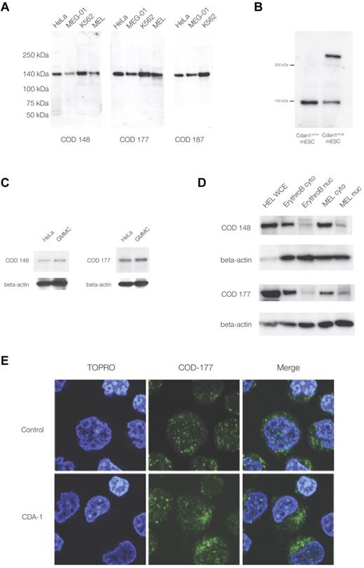 Figure 1. Western immunoblotting and immunofluorescence microscopy with murine monoclonal anti-codanin-1 (COD53, COD177, and COD187) antibodies. (A) Western (full-range) blot with the 3 uncloned hybridoma supernatants. Lanes correspond to HeLa, MEG-01, MEL, and K562 cell line protein extracts. (B) Western blot of whole-cell extracts of mESCs (E14) probed with the COD177 antibody. Bands of approximately 140 kDa (wild-type codanin-1) and more than 250 kDa (codanin-1/β-geo fusion) are visible. This demonstrates the specificity of the monoclonal antibody against the wild-type codanin-1 and a fusion protein of the expected size generated by gene-trapping one allele of Cdan1 (“A mouse model with a gene-trap plasmid in the Cdan1 gene”). (C) Western blot of nonerythroid brain cell line GMMC and HeLa cell line extracts. (D) Comparison of whole-cell extracts (WCE), cytoplasmic (cyto), and nuclear extracts (nuc) from cultured intermediate erythroblasts (ErythroB), and MEL cell line. (E) Immunofluorescence staining of control and CDA-1 primary human erythroblasts using the COD-177 antibody. DNA is counterstained with TOPRO-3.