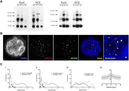 Figure 4. Colocalization of codanin-1 with HP1α and Sec23B. (A) Coimmunoprecipitation results. (Left) Whole-cell (WCE) and nuclear (NucE) protein extracts precipitated with the anti-HP1α antibody and blotted with the anti-codanin-1 antibody (COD177). (Right) Protein extracts (WCE, NucE) precipitated with the anti-Sec23B antibody and blotted with the anti-codanin-1 antibody (COD177). Nonspecific bands are immunoglobulins and their complexes. (B) Codanin-1 and Sec23B colocalization in an erythroblast by immunofluorescence. (Ci-ii) Nearest-neighbor distance measurements between codanin-1 and Sec23B foci (and reciprocally) extracted from confocal images from 600 cells. A histogram of simulated nearest-neighbor distance measurements generated in a random model of 10 foci/cell adjusted for volume and contour (cell and nucleus) is plotted in comparison. Each simulated histogram is generated by calculating distances from a random reference focus (Sec23B or codanin-1) to a nearest possible random neighbor focus (codanin-1 or Sec23B) in a virtual cell of similar cyotplasmic and nuclear proportions. The x-axis represents the distance in pixels; and y-axis, the number of distances measured. These graphs suggest that colocalization of codanin-1 and Sec23B is not random. (Ciii) The number of foci/cell impacts simulated histograms. Shown are 2 simulated histograms with either 2 or 10 foci/cell. In the 600 cells analyzed, the average number of foci was approximately 10. (Civ) Representation of Pearson colocalization model (X = 0 center of focus), suggesting colocalization of foci. Background noise accounts for low index values, and only trend is interpretable.