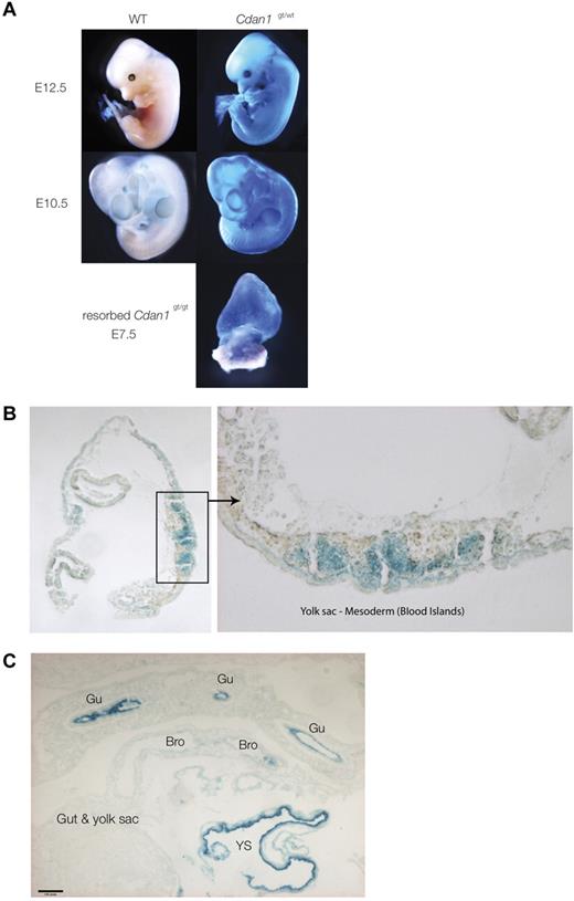 Figure 6. X-Gal staining of whole heterozygote Cdan1gt/wt embryos. (A) Whole mounts at different stages of development. The only homozygous embryo Cdan1gt/gt, as shown in Table 1, obtained in this study clearly shows strong X-Gal staining, demonstrating Cdan1 expression from both gene-trapped alleles. (B) Intense X-Gal staining of yolk sac mesoderm-blood islands in Cdan1gt/wt embryos at E7.5 in cross section. (C) Intense X-Gal staining of a wide range of cell populations in Cdan1gt/wt embryos at E10.5. Bro indicates bronchus; Gu, gut; and YS, yolk sac.