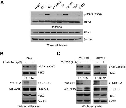 Figure 1. RSK2 is activated in diverse human leukemia cells transformed by different leukemogenic tyrosine kinases including BCR-ABL and FLT3-ITD. (A) Immunoblotting detects S386 phosphorylation of RSK2 in diverse hematopoietic cancer cell lines expressing diverse leukemogenic tyrosine kinases, including EOL-1 (HIP1L1-PDGFRA), HEL (JAK2 V617F), KARPAS (NPM-ALK), K562 (BCR-ABL), Molm14 (FLT3-ITD), Mo91 (TEL-TrkC), OPM1 (FGFR3). ANBL6 is a human myeloma cell line without dysregulated expression of tyrosine kinase and included as a negative control. (B-C) Immunoblotting shows that targeting BCR-ABL by imatinib in K562 cells (B) and FLT3 by TKI258 in Mv(4;11) and Molm14 cells (C) decreases phosphorylation of RSK2 S386.
