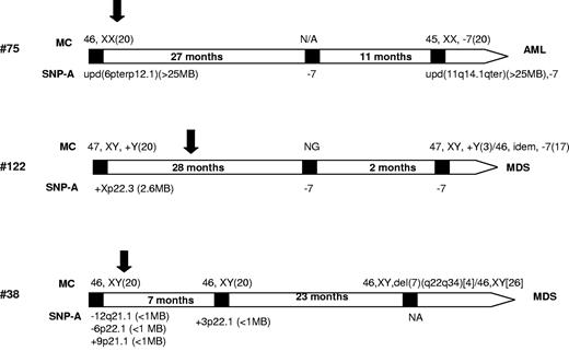 Figure 4. Behavior of SNP-A characterized lesions through the clinical course. Using SNP-A–based karyotyping, clonal monosomy 7 was identified earlier in some patients in our cohort (nos. 122, 75, 38). In addition, SNP-A analysis identified clonal lesions in a patient (no. 38) before immunosuppression that disappeared posttreatment. Number 75 had normal cytogenetics by MC at presentation but SNP-A analysis revealed a uniparental disomy (UPD). Black squares indicate clinical time points where karyotyping was performed using SNP-A and/or metaphase cytogenetics. The metaphase karyotype is given above and the SNP-A-based karyotype below the bars representing the clinical course. NG indicates no growth of the metaphase culture; and NA, result not available. Black arrows indicate when immunosuppression was initiated. The time given in months indicates the length of time between karyotype timepoints.