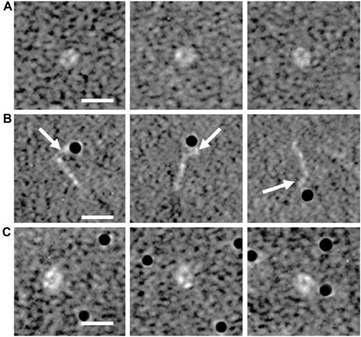 Figure 5. Electron microscopy analysis of β2GPI. Purified human plasma β2GPI was visualized with electron microscopy in the absence or presence of gold-labeled (black dots) LPS or albumin. Magnifications of purified plasma β2GPI show a circular conformation (A). Purified plasma β2GPI in the presence of gold-labeled LPS shows on magnification an open fishhook-like shape of β2GPI (B), where LPS is bound to domain V of β2GPI, as indicated with the white arrows. Incubation of plasma β2GPI with gold-labeled albumin, as a control, does not induce a conformational change of β2GPI (C). White bar represents 10 nm.