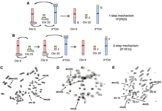 Figure 1. Mechanisms of genesis and FISH analysis of variant translocations. Shown are the 1-step mechanism (A) and the 2-step mechanism (B). The segments in the open boxes exchange material, as shown by the curved arrows. The letters indicate the probe colors used in FISH studies: R for red, labeling the ABL1 gene sequence region; G for green, labeling the BCR green sequence region; and F for fusion.4 (C) Case n.17, 46, XY, t(9;9;22)(q34;q34;q11). (D) Case n.19, 46, XX, t(9;22;22)(q34;q11;q11), t(7;19)(q21;p13). (E) Case n.23, 46, XY, t(9;22;12)(q34;q11;q24). BCR is shown by the green signal, ABL by the red signal, and fusion by the green/red signal (see “Results”).