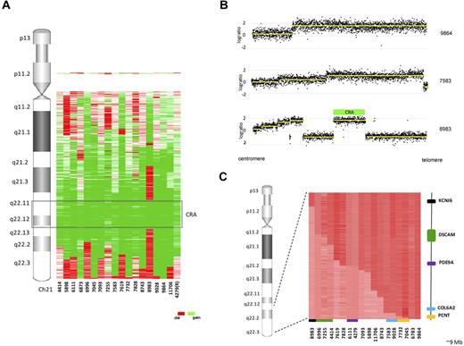 Figure 1. Summary of chromosome 21 abnormalities in 18 iAMP21 patients. (A) Heat map of chromosome 21 abnormalities detailing the regions of deletion (red), gain (green), and normal copy number (white) relative to genomic location. The CRA, as defined by sample 8983, is highlighted and R denotes that 4279 is a relapse sample. (B) Examples of chromosome 21 profiles from 3 iAMP21 patients clearly demonstrating the complexity and diversity of abnormalities targeting this chromosome. Sample 9864 has a single region of amplification and no telomeric deletion, sample 7583 has a characteristic stepwise profile with a telomeric deletion, and sample 8983 demonstrates a complex stepwise profile with interspersed regions of deletion. The CRA was defined by sample 8983, which is highlighted by a green bar. (C) Heat map showing the telomeric break points (indicated by a change from dark to light red) on chromosome 21 for the 18 patients profiled by aCGH. The region spans ∼ 9 mb, and the most centromeric and telomeric genes with break points, their relative location to the heat map, and the corresponding samples are shown. KCNJ6 is shown in black and PCNT in orange. Recurrent break points were identified in 4 genes: PDE9A (purple) and COL6A2 (blue) had identical break points, but the break points in DSCAM (green) and PCNT (orange) occurred at different genomic positions.