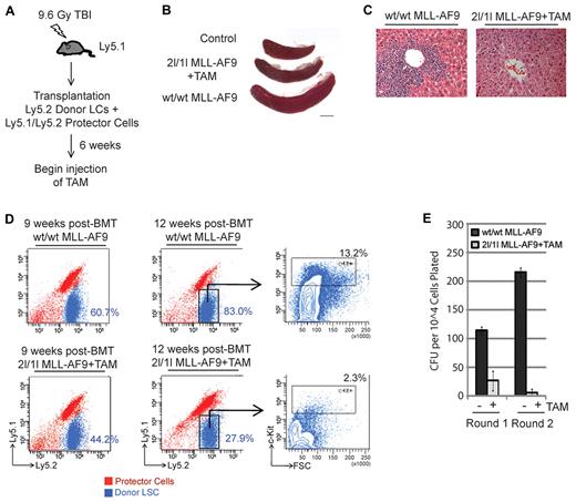 Figure 4. DOT1L is required for MLL-AF9–induced acute leukemia progression in vivo. (A) Diagram of BMT procedure to examine the requirement of DOT1L in MLL-AF9 AML progression. TAM treatment began at 6 weeks after transplantation after leukemia development. (B-E) In vivo deletion of DOT1L prevents MLL-AF9 AML progression. (B) Reduced spleen size in TAM-treated 2lox/1lox MLL-AF9 recipient mice. Representative images of spleens harvested from transplanted mice at 9 weeks after transplantation (n = 3 per group). (C) TAM-induced DOT1L deletion prevents leukemic infiltration of the liver. Representative H&E staining of liver tissue sections at 9 weeks after transplantation (n = 3 per group). (D) On DOT1L depletion, the percentage of transformed donor cells in bone marrow diminishes over time. FACS analysis of bone marrow cells isolated from transplanted mice (n = 3 per group, per time point). Donor MLL-AF9 cells are Ly5.2+ (blue) and recipient/protector cells are Ly5.1+/Ly5.2+ (red). Percentage of donor Ly5.2 cells in the total bone marrow cell population at 9 and 12 weeks after transplantation are indicated. At 12 weeks after transplantation, cells were also stained with the stem cell/progenitor marker c-Kit. Transformed donor Ly5.2 population is gated and percentage of c-Kit+ cells indicated. Shown are representative images from 3 independent experiments. (E) Loss of clonogenic leukemic stem cells after in vivo DOT1L depletion. Methylcellulose colony formation assay of donor cells sorted from mice at 12 weeks after transplantation. Average CFUs are shown (n = 3). Error bars represent SD.