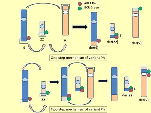 One-step and 2-step mechanisms of variant Ph. A variant Philadelphia chromosome (Ph) is generated from translocation of 1 or more partner chromosomes in addition to chromosomes 9 and 22. One-step mechanism of variant Ph: 3 breaks and reciprocal rejoining occur at the same time on chromosome 9, 22, and partner chromosome. Two-step mechanism of variant Ph: the standard t(9;22) is formed and then the segment of der9 exchanges material with the variable partner chromosome. V indicates variable partner chromosome; G, green signal; R, red signal; and F, fusion signal.