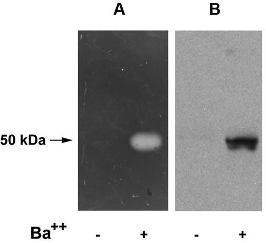 Figure 4. Reverse fibrin zymography of catecholamine storage vesicle proteins. PC12 cells were incubated at 37°C for 30 minutes in release buffer in the presence (+) or absence (−) of the secretagogue, BaCl2 (2 mM). The releasates were electrophoresed on 10% SDS gels and subjected either to reverse fibrin zymography as described in “Reverse fibrin zymography” (A), or Western analysis using an IgG fraction of rabbit anti–rat PAI-1 (B).