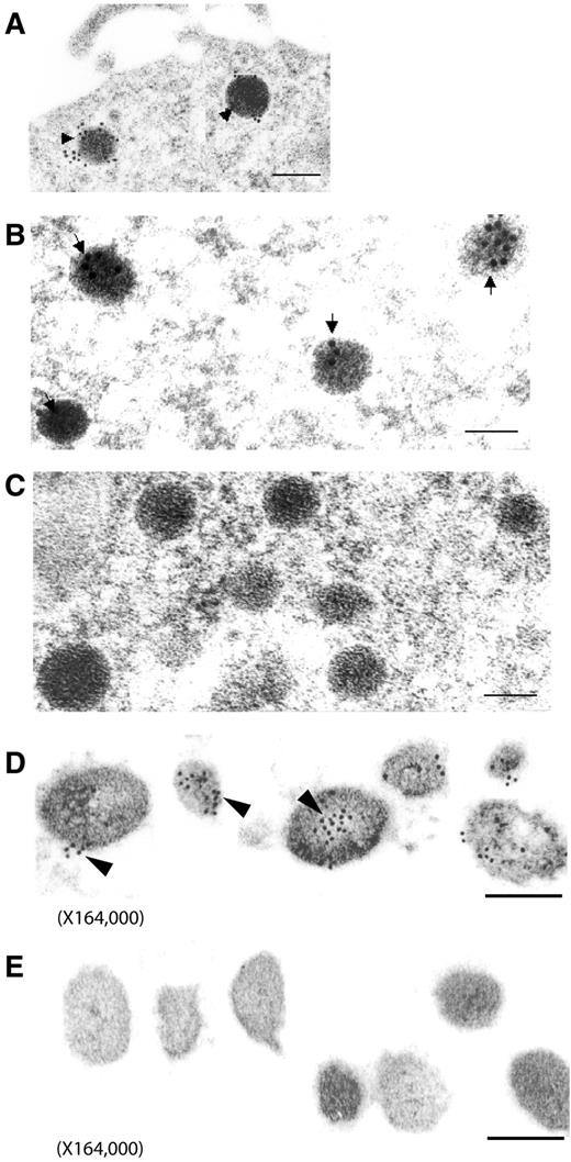 Figure 5. Immunoelectron microscopy of PAI-1 in catecholamine storage vesicles. (A-C) PC12 cells were prepared for immunoelectron microscopy as described in “Immunoelectron microscopy of PAI-1 in PC12 cells and chromaffin granules.” PAI-1 antigen was detected in PC12 cells as gold particles in catecholamine storage vesicles using specific rabbit anti–rat PAI-1 IgG and goat anti–rabbit IgG conjugated to 10-nm colloidal gold particles (arrowheads in panels A and B). Controls (C) indicated a paucity of immunolabeling when normal rabbit IgG was used as the primary antibody. The bar in panel A corresponds to 200 nm, the bars in panels B & C to 100 nm. Magnification: A, 48 000; B-C, 110 250. (D-E) Isolated bovine chromaffin vesicles were prepared for PAI-1 immunoelectron microscopy as described in “Cells and tissues.” PAI-1 antigen was detected in isolated bovine chromaffin vesicles as gold particles using specific rabbit anti–rat PAI-1 IgG and goat anti–rabbit IgG conjugated to 10-nm colloidal gold particles (D). Controls (E) indicated a paucity of immunogold staining when rabbit IgG was used as the primary antibody. The bars in panels D & E correspond to 100 nm. Magnification: 164 000.