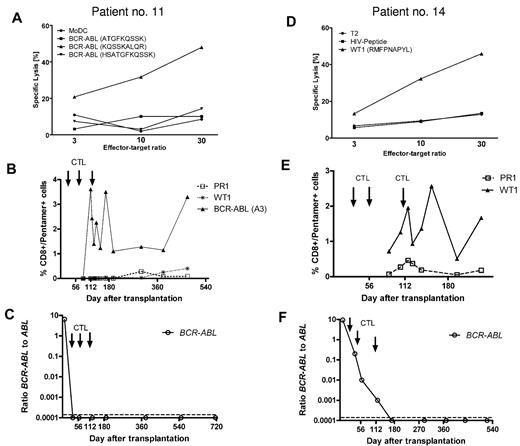 Figure 3. In vitro cytotoxicity of CD8+ T cells, the frequency of peptide-specific CD8+ T cells in vivo, and B-cell receptor–ABL levels. In vitro cytotoxicity of infused CTLs was tested with peptide-loaded antigen-presenting cells (DCs or T2 cells) as targets. Panels A and D confirm antigen-specific cytotoxicity against a human leukocyte Ag-A3–restricted B-cell receptor–ABL-derived peptide (A) and an human leukocyte Ag-A2-binding WT1 peptide (D) in patients 11 and 14, respectively. (B,E) The corresponding frequency of human leukocyte Ag/peptide tetramer-positive CD8+ T cells after transplantation and CD8+ T-cell infusion in each case. (C,F) B-cell receptor–ABL mRNA became undetectable in both patients, and PCR negativity was maintained until the last follow-up.