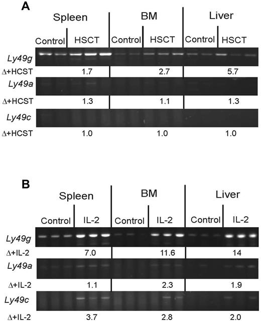 Figure 6. Preferential induction of Ly49G2 transcripts by HSCT and IL-2. RT-PCR (35 cycles) of Ly49 Pro1 transcripts was performed with primers specific for Ly49G2, Ly49a, and Ly49c/i. The identity of all products was confirmed by DNA sequencing. (A) Detection of Ly49 Pro1 transcripts after HSCT. RNA was isolated from the spleen, BM, or liver of mice receiving hematopoietic stem cell transfer HSCT or control mice. The numbers under each panel (Δ+HCST) indicate the average -fold induction of the transcript by HCST as measured by SYBR-Green quantitative PCR. (B) Induction of Ly49 Pro1 transcripts by in vivo IL-2 treatment. Induction (fold) in response to IL-2 treatment is shown under each panel (Δ+IL-2). Data are representative of 3 experiments.