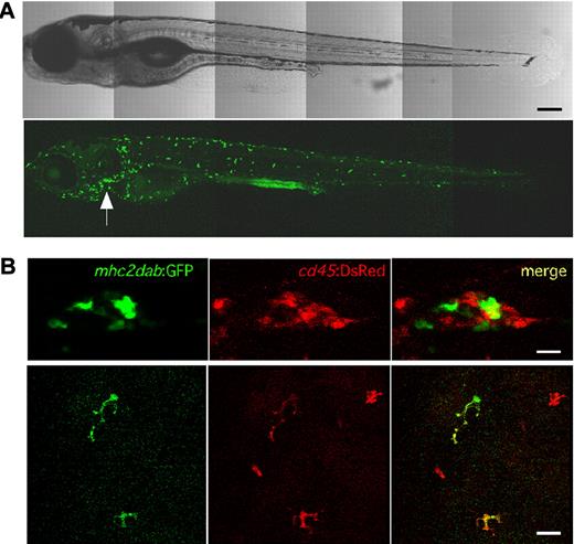 Figure 1. Expression of the mhc2dab:GFP and cd45:DsRed transgenes during zebrafish development. (A) Lateral view of a 14-dpf mhc2dab:GFP transgenic fish showing reporter expression in cells scattered throughout the skin and in the thymus (arrowhead). The scale bar indicates 200μm. (B) Thymic (top panel) and skin (bottom panel) reporter expression in a double cd45:DsRed; mhc2dab:GFP transgenic fish at 12 dpf. For each location, the GFP (left), DsRed (middle), and merged (right) images are shown. The scale bar indicates 20μm.