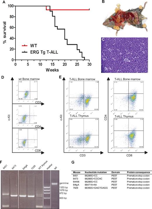 Figure 1. ERG induces T-ALL in mice. (A) Life expectancy of ERG transgenic mice. Kaplan-Meier survival curves of ERG transgenic mice with T-ALL and wild-type littermate controls (WT). (B) An ERG transgenic mouse with T-ALL dissected to show its internal organs. There is enlargement of the thymus (T), spleen (S), and liver (L). (C) Histology of the thymus of an ERG transgenic mouse with T-ALL. An H&E-stained thymus showing dense leukemic cell infiltration. (D) Flow cytometric analysis of bone marrow from wild-type mice. (E) Flow cytometric analysis of bone marrow and thymus from transgenic ERG mice. The cell surface markers were measured relative to isotype control. The percentage of positive cells is indicated in the corner of each quadrant. (F) T-cell receptorβ rearrangements. PCR products showing Dβ2-Jβ rearrangements in thymus from 4 ERG transgenic mice compared with wild-type thymus and tail (germline). (G) Notch1 mutations. Insertion or deletion mutations in the Notch1 PEST domain in 5 ERG transgenic mice.