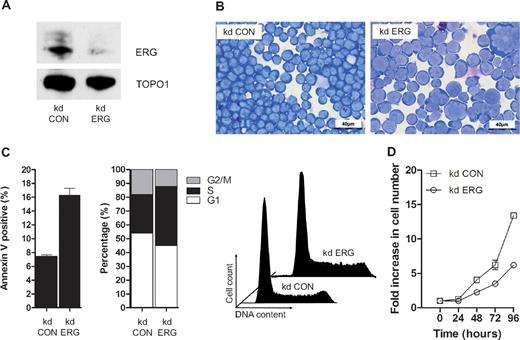 Figure 2. ERG plays a nonredundant role in proliferating T-ALL cells. (A) ERG knockdown (kd) in MOLT4 cells. A Western blot of nuclear lysates from MOLT4 clones transduced with retroviral vectors encoding either control shRNA (kd CON) or shRNA targeting ERG (kd ERG) vectors showing reduced ERG protein in the latter relative to DNA topoisomerase 1 control. (B) Morphology; cytospins of MOLT4 cells transduced with either the control vector (kd CON) or knockdown vector (kd ERG) stained with Wright stain. (C) Cell-cycle kinetics and viability: kd ERG MOLT4 cells show increased apoptosis and impaired progression through the cell cycle. These data are representative of duplicate experiments each recording 105 events. (D) Comparative growth curves: MOLT4 cells stably transduced with an ERG knockdown vector show a significant reduction in growth rate compared with those transduced with a control vector. The data show replicates of 3 separate experiments each using a starting number of 105 control and ERG knockdown cells.
