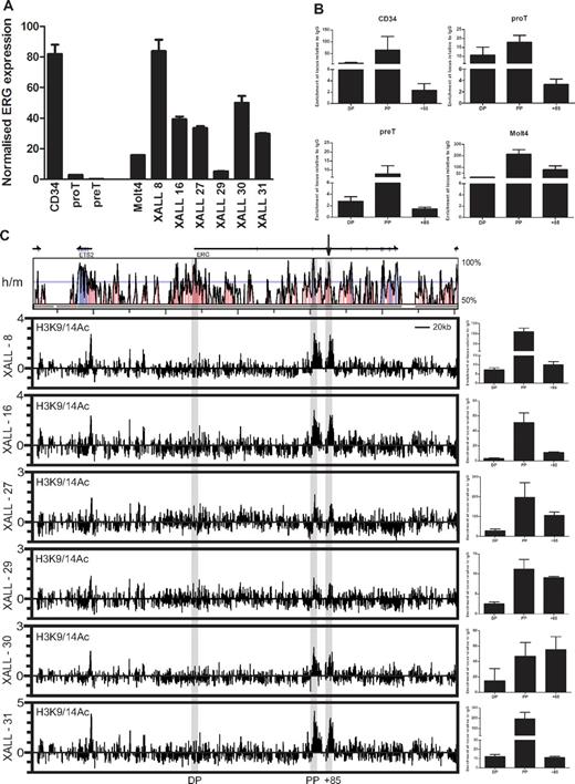 Figure 3. The ERG stem cell enhancer is active in human T-cell progenitors and in T-ALL. (A) Relative ERG expression in normal and leukemic cells. RNA was isolated from MACS- or FACS-sorted cord blood CD34+ cells, cultured T-cell progenitors and T-ALL xenografts, and ERG expression quantified by SYBR Green qPCR and expressed relative to GAPDH or β actin. ERG is expressed in CD34+ stem cells, but is rapidly down-regulated during T-cell differentiation. However, ERG is highly expressed in MOLT4 and xenograft T-ALL cells. (B) Chromatin accessibility at the ERG promoters and +85 enhancer in normal and leukemic cells. Chromatin accessibility measured by histone H3K9/K14 acetylation (AcH3) in CD34+ stem/progenitors, developing T cells, and MOLT4 T-ALL cells. AcH3 enrichment at the ERG proximal promoter (PP) and +85 element in the various cell types corresponds with ERG expression. (C) Chromatin accessibility across the ERG locus in NOD/SCID T-ALL xenografts. The top panel shows a VISTA plot of human/mouse sequence conservation > 50% across the ERG locus and flanking genes. The ERG promoters and enhancer are highlighted by gray bars. The +85 enhancer is also marked by an arrow. The bottom graphs show chromatin accessibility as determined by AcH3 ChIP-chip and ChIP-PCR in T-ALL xenografts. ChIP-chip plots show AcH3 enrichment along the ERG locus and flanking genes; clusters of AcH3 enrichment are seen at the ERG PP and +85 element in 6/6 T-ALL xenografts. Graphs at right show these peaks of enrichment confirmed by ChIP-PCR.