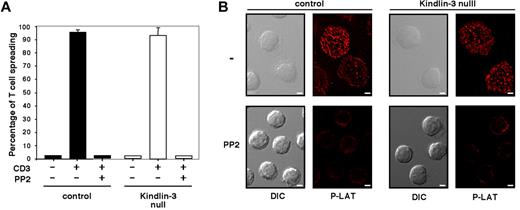 Figure 2. Kindlin-3 is not required for SFK-dependent TCR-mediated signaling and spreading. (A) Control (black bars) or Kindlin-3–null (white bars) PB T cells were pretreated with carrier (DMSO 0.1%) or PP2 (10μM for 30 minutes at 37°C) and allowed to spread on immobilized anti-CD3 mAb (OKT3, 20 μg/mL). Results are the mean ± range of 2 fields. The experiment shown is representative of 2. (B) PB T cells spread on anti-CD3 mAb as in panel A were fixed and stained with anti–phospho LAT antibodies. DIC and fluorescence images of cells are shown in a representative field. Scale bar represents 3 μm.