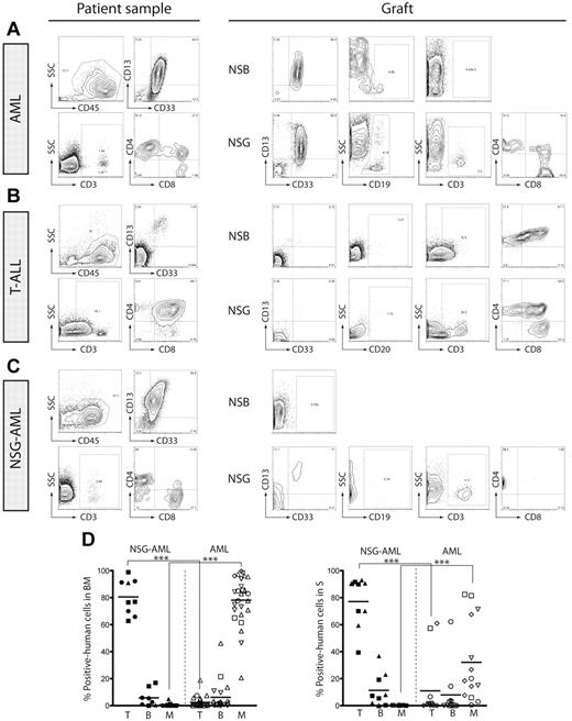 Figure 1. NSG-engrafting AMLs produce a lymphoid graph in NOD/SCID IL2Rγcnull mice. BM cells from (A) AML- (AML#2), (B) T-ALL-, and (C) NSG-engrafting AML (AML#23)-transplanted NOD/SCID β2−/− and NOD/SCID IL2Rγcnull mice were analyzed by flow cytometry. Surface expression of myeloid-cell (CD33 and CD13 inside CD45-positive population), B-cell (CD19 inside CD45-positive population) and T-cell (CD3, and CD4/CD8 inside CD3+ population) markers is represented. Phenotype of de novo isolated (A) AML, (B) T-ALL, and (C) NSG-AML is represented in the left panel. (D) Summary of the human graft composition (inside human CD45-positive population) in BM (left) and spleen (right) of AML-transplanted NOD/SCID IL2Rγcnull mice. Myeloid, B and T cells are defined by the expression of CD13/CD33; CD19; and CD3, respectively. Black indicates NSG-AML samples; and white, AML samples. Each symbol represents a specific AML sample. Individual mice are graphed. NSG-AML: AML#22, #23, #24; 9 mice. AML: AML#2, #4, #5, #6, #11, #20, #21; 22 mice. ***P ≤ .00001.