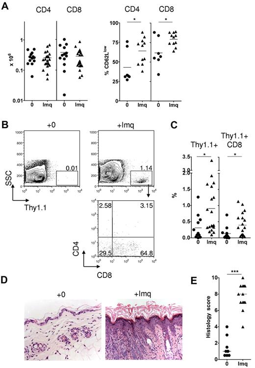 Figure 3. Topical imiquimod induces recruitment of donor CD8 cells and GVHD in the skin of allogeneic chimeras. MCs were treated with 3 mg topical imiquimod (Imq) or nil in an area of approximately 2.25 cm2 above the base of the tail at day 0, day 5, and day 10 after donor splenocyte transfer. (A) Left: Absolute numbers of Thy1.1+ CD4 or CD8 cells in the skin draining LN at day 14 (n = 13-21 mice per group); data pooled from 8 independent experiments. The mean is indicated by the horizontal bar. Right: Percentage of gated Thy1.1+ CD4 or CD8 cells on day 14 that were CD62Llow (n = 7-11 mice per group); data pooled from 3 independent experiments. *P < .05. The mean is indicated by the horizontal bar. (B) Representative contour plots (top row) showing accumulation of Thy1.1+ cells in the epidermis at day 14. Plot in the bottom row represents CD4 and CD8 expression in gated Thy1.1+ cells of imiquimod-treated MCs. (C) Summary data showing accumulation of total Thy1.1+ cells (left) or Thy1.1+ CD8 cells (right) in the epidermis of control or imiquimod-treated MCs (n = 12-19 mice per group); data pooled from 8 independent experiments. *P < .05. The mean is indicated by the horizontal bar. (D) Representative histologic sections showing skin histology on day 14 in imiquimod-treated and control mice (original magnification ×200). (E) Summary data of histologic GVHD score as evaluated single blind (n = 9-13 per group); data pooled from 4 inde-pendent experiments. ***P < .001. The median is indicated by the horizontal bar.