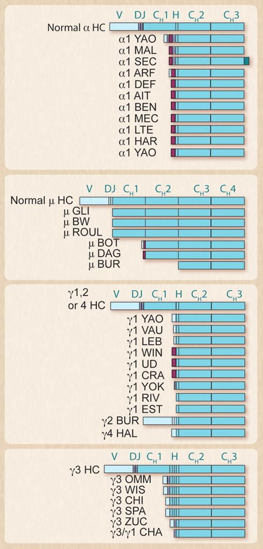 Figure 2. Structure of various HCD proteins compared with that of the corresponding normal chain. Shown are the HCD proteins for which the complete sequence is known. V indicates variable region; D, diversity segment; J, joining region; H, hinge region; and CH1, CH2, CH3, and CH4, constant regions of heavy chains. Light turquoise indicates sequences derived from variable region; turquoise, sequences derived from CH domains or hinge region; hashed boxes, sequences derived from D or J segments; purple, unusual amino acid sequences; and dark turquoise, amino acids of the membrane-bound form of HC. Adapted from Buxbaum and Alexander.7 Note that α1SEC exists only in the membrane form.