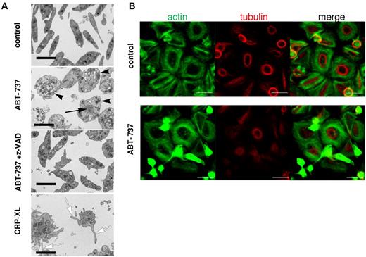 Figure 5. Platelet apoptosis is characterized by ultrastructural changes distinct from platelet activation. (A) Washed human platelets incubated in HBS retained their normal discoid shape and ultrastructure, whereas treatment with ABT-737 (100nM) for 2 hours resulted in their distension with displacement of granules toward the periphery of the rounded-up cells (black arrowheads). Many of these cells also displayed focal aggregations of cytoskeletal material (black arrow). These changes were all prevented by the incorporation of z-VAD.fmk (50μM) into the medium. Treatment with CRP-XL (2 μg/mL) for 15 minutes resulted in a completely different morphology with the proliferation of numerous filopodia (white arrows) and microparticles. Bars represent 2 μm. (B) Platelets were incubated in HBS with or without ABT-737 (100nM) for 2 hours before analysis by immunohistochemistry and confocal microscopy. Actin was stained using phalloidin/Alexa-488 (green), and tubulin was stained using anti–tubulin/phycoerythrin (red). Bar represents 5 μm.