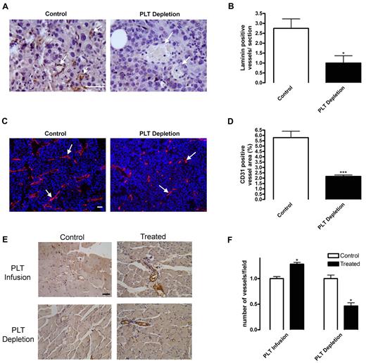 Figure 3. Blood vessel density is diminished upon platelet depletion. (A-D) Subcutaneous B16-F10 tumors were implanted in mice undergoing platelet (PLT) depletion or injected with control rat IgG. After 9 days of growth, tumors were excised and sectioned. (A-B) Tumor sections were stained for laminin to visualize blood vessels. Laminin-positive vessels were quantified and represented as mean vessel number per section ± SEM (n = 6). (C-D) Frozen tumor sections were stained for CD31-positive vessels (red) and DAPI (blue). CD31+ blood vessels were quantified and represented as mean percentage of area ± SEM (n = 24). Arrows indicate vessels within the tissues. (E-F) Platelets were depleted or infused in mice directly after hindlimb ischemia surgery. Muscles were collected from mice injected with 3 × 109 platelets (PLT Infusion, Treated) or PBS (PLT Infusion, Control). Muscles were also collected from mice injected with rat anti–mouse GPIbα (PLT Depletion, Treated) or rat IgG (PLT Depletion, Control). Muscles were sectioned 14 days after surgery and immunostained for VWF positive blood vessels. Vessels positive for VWF were counted and represented as mean vessel number per field ± SEM (n = 5). Scale bars represent 50 μm. *P < .05 and ***P < .005 vs control by Student t test.