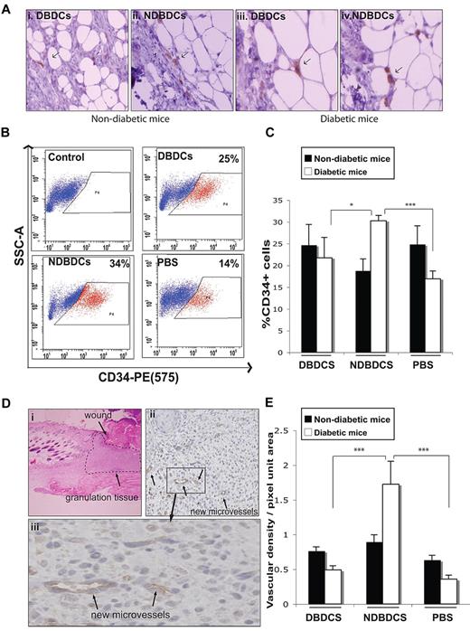 Figure 2. Nondiabetic-derived Gr-1+CD11b+ cells promote injury-induced neovascularization. (A) Detection of GFP+ Gr-1+CD11b+ cells (arrows) 5 days after injection into wounds. (B) Representative plots from flow cytometric analysis of CD34+ cells (red) and CD34− cells (blue) in wounds following injection of Gr-1+CD11b+ cells into wounds. (C) Quantification of flow cytometric analysis data (as in panel B) of CD34+ cells from digested wound tissue from each treatment group at day 7 after wounding. (Di) A representative hematoxylin and eosin staining of 5-μm sections of day 7 wounds showing area used for analysis of neovascularization (granulation tissue). Image shown is original magnification ×40. (ii-iii) Representative images of immunohistochemistry of 5-μm wound sections labeled with anti-CD34 antibody (brown), and counterstained with hematoxylin (blue). Arrows show new microvessels. Images shown are original magnification ×400 (ii) and ×1000 (iii). (E) Quantification of CD34+ microvessels in wound tissue sections as shown in panel D. DBDCs, diabetic-derived Gr-1+CD11b+ cells; NDBDCs, nondiabetic-derived Gr-1+CD11b+ cells; PBS, phosphate-buffered saline. Error bars represent SEM, *P ≤ .05, ***P ≤ .001.