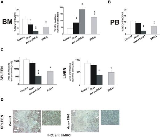 Figure 7. Effects of combined treatment with E4031 and dexamethasone in vivo. (A) NOD-SCID mice (n = 16, 4 for each group) were inoculated with REH cells on day 0, and 1 week after inoculation were treated with: (i) saline, (ii) E4031 (20 mg/kg), (iii) dexamethasone (15 mg/kg), or intravenous dexamethasone (15 mg/kg) plus E4031 (20 mg/kg) for 2 weeks. At the end of treatment, mice were killed and bone marrow, spleens, and livers were collected. Left panel, bone marrow engraftment in control, dexamethasone-, dexamethasone + E4031-, and E4031-treated mice, quantified by determining the percentage of hCD45+ versus mCD45+ cells by flow cytometry. Right panel, FragEL staining of bone marrow from mice inoculated with REH cells and treated as in panel A. Results show the number of TUNEL-positive leukemic cells per microscopic field (epiphysis or diaphysis, 40× magnification). The data are means ± SD of triplicate experiments. (B) Peripheral blood invasion in control, dexamethasone-, dexamethasone + E4031-, and E4031-treated mice, quantified by determining the percentage of hCD45+ versus mCD45+ cells by flow cytometry. (C) Extent of leukemic cell invasion in the spleen (left) and in the liver (right) of mice inoculated with REH cells and treated as in panel A. The extent of leukemic cell infiltration was calculated by anti-hMHCI staining measured with Leica DC Viewer software at 40×. Images were acquired on a Leica DM 4000B microscope with a Leica DFC 320 camera (Leica Microsystems; PL Fluotar 40×/0.70 objective) *P < .05. (D) Immunohistochemical staining with an anti-hMHCI antibody of the spleens of mice inoculated with the REH cell line and treated as in panel A. Scale bar = 50 μm. Inset, magnification of images reported on the left. *P < .05; **P < .01; ***P < .001
