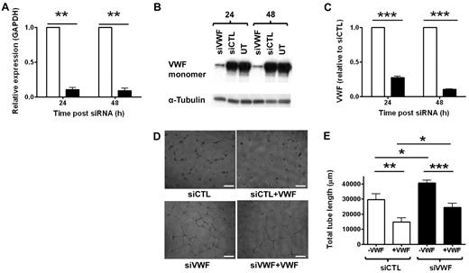 Figure 1. VWF-deficient cells display enhanced angiogenesis in vitro. VWF-specific (20nM; siVWF, closed bars), or control siRNA (20nM; siCTL, open bars) was transfected into HUVECs for 24 or 48 hours. VWF expression was measured in these cells by (A) RT-PCR, (B) Western blotting (representative blot shown), or (C) VWF ELISA. (D) HUVECs treated with control or VWF-specific siRNA for 24 hours were seeded onto Matrigel. Capillary network formation was observed in the presence (right panels) or absence (left panels) of 10 μg/mL VWF after 24 hours and quantified in panel E by measuring total tube length in micrometers. (Bar = 200 μm). Data for siVWF in panels A and C have been normalized to siCTL. siCTL, nonspecific siRNA-treated cells; siVWF, VWF siRNA-treated cells; UT, untreated cells (n = 3). Error bars = mean ± SEM. *P < .05; **P < .01; ***P < .001 (Student t test).