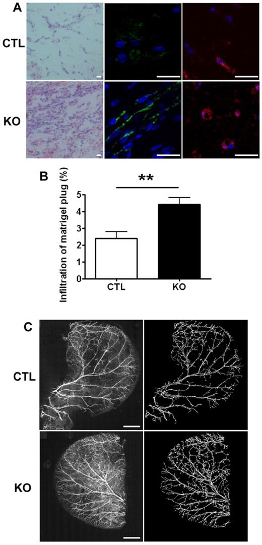 Figure 4. VWF-deficient mice display increased angiogenesis and mature blood vessel density. (A) Matrigel was injected subcutaneously into littermate control (CTL; top panels) or VWF-deficient mice (KO; bottom panels). Seven-day-old plugs were excised, sectioned, and stained with hematoxylin and eosin (left panels), or for immunofluorescence microscopy, with anti-CD31 (middle panels) or VEGFR-2 (right panels). Size bar = 20μm. (B) Cellular infiltrate was quantified in hematoxylin and eosin sections from CTL (open bars) or KO (closed bars). n = 5 KO mice and n = 6 CTL mice. (C) CTL or KO mice were culled and whole ears were removed. Ears were stained with anti–α-SMA-Cy3 and a tile scan was performed to obtain a composite image of the whole ear (left panels). Size bar = 2 mm. Blood vessels were identified, segmented, and converted to binary images (right panels). Total ear area, blood vessel area (relative to total ear area), and fractal dimensions were calculated. n = 5 KO mice and n = 7 CTL mice, Error bars indicate mean ± SEM. **P < .01 (Student t test).