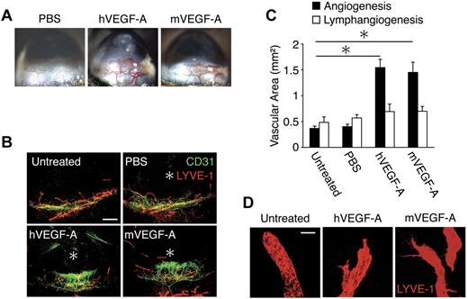 Figure 1. VEGF-A–induced lymph- and angiogenesis. Pellets containing hVEGF (200 ng) or mVEGF-A (200 ng) were implanted into the corneas of C57BL/6 mice. Corneal lymph- and angiogenesis were examined on day 6 after implantation. (A) Microscopic pictures of corneal neovascularization. (B) Double staining of corneal flat mounts for angiogenesis (CD31) and lymphangiogenesis (LYVE-1). *Implanted pellets. Bar, 400 μm. (C) Quantitative analysis of vascular area (black) and lymphatic area (white; n = 4-8). (D) Blind round tips of lymphatics in normal corneas and branched sharp tips in VEGF-A–stimulated corneas of confocal images. Bar, 30 μm. *P < .05.
