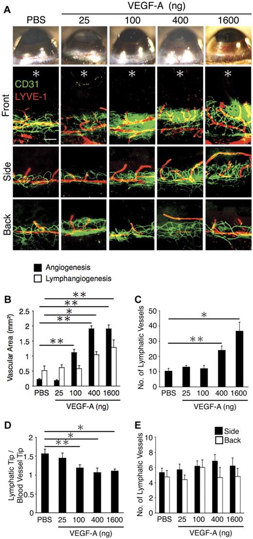 Figure 2. VEGF-A–concentration dependent corneal angiogenesis and lymphangiogenesis. Control pellets (PBS) or pellets with varying amounts of VEGF-A (25, 100, 400, and 1600 ng) were implanted into the corneas of C57BL/6 mice. Corneal angiogenesis and lymphangiogenesis were examined on day 6 after pellet implantation. (A) Double staining of corneal flat mounts for angiogenesis (CD31, green) and lymphangiogenesis (LYVE-1, red) in the front, side, and the back of the cornea. *Implanted pellets. Bar, 200 μm. (B) Quantitative analysis of angiogenesis and lymphangiogenesis on day 6 (n = 5-8). (C) Quantitation of the number of LYVE-1(+) lymphatic vessels in corneas of PBS or VEGF-A– (25, 100, 400, or 1600 ng) implanted animals (n = 5-6). (D) Ratio of the distance of lymphatic tips and vascular tips from limbal vessels in corneas of PBS or VEGF-A– (25, 100, 400, or 1600 ng) implanted animals (n = 15-22). (E) Quantitation of the number of lymphatic vessels (n = 4-10). Bar, 200 μm. *P < .05; **P < .01.