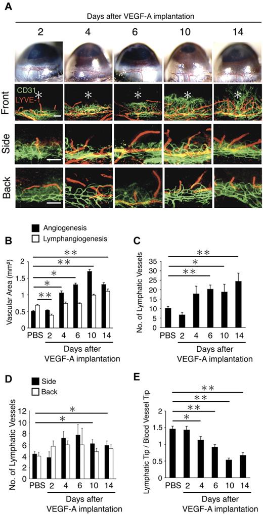 Figure 3. Time course of VEGF-A–dependent corneal lymph- and angiogenesis. (A) Double staining of corneal flat mounts for lymph- (LYVE-1, red) and angiogenesis (CD31, green) in the front, side, and the back of the cornea. Bar, 200 μm. (B) Quantitative analysis of lymph- and angiogenesis on the indicated day after VEGF-A implantation (n = 4-8). (C) Quantitation of the number of LYVE-1(+) lymphatic vessels in corneas of PBS or VEGF-A–implanted animals (n = 4-6). (D) Ratio of the distance of lymphatic tips and vascular tips from limbal vessels in corneas of PBS or VEGF-A–implanted animals (n = 12-18). (E) Quantitation of the number of lymphatic vessels (n = 4-10). Bar, 200 μm. *P < .05; **P < .01.