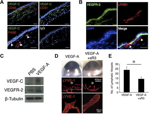 Figure 4. Contribution of VEGFR-3 to VEGF-A–induced lymphangiogenesis. Corneas were implanted with pellets containing VEGF-A (200 ng). Corneal sections were examined on day 6 after implantation. (A) Double immunostaining of corneal sections with VEGF-C (green) and CD45 (red), CD31 (red), or F4/80 (red). Bar, 50 μm. (B) Double immunostaining of VEGF-A–implanted corneal sections with VEGFR-3 (green) and LYVE-1 (red). Arrowheads indicate VEGFR-3–positive lymphatic endothelium. Bar, 50 μm. (C) Representative Western blot of samples of PBS or VEGF-A–implanted corneas (day 6) with Abs of VEGF-C, VEGFR-2, or β-tubulin. (D) Pellets containing VEGF-A or VEGF-A+sR3 were implanted into the corneas of C57BL/6 mice (day 6). *Pellet implantation site. LYVE-1 (red). (E) Quantitation of the number of lymphatic vessels in VEGF-A–implanted corneas with or without sR3 on day 6 (n = 6-8). *P < .05.
