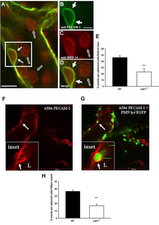 Figure 2. In vivo endothelial dome formation in WT mice visualized by whole-mount staining of the cremaster muscle and 2-photon microscopy. The cremaster of C57BL/6 WT mice was fixed in paraformaldehyde and stained for platelet endothelial cell adhesion molecule-1 (PECAM-1; green, Alexa 488) and MRP-14 (red, Alexa 568) 3 hours after application of IL-1β into the scrotum. (A) Overview merge of a postcapillary venule showing a migrating neutrophil covered by a dome (arrows in box; scale bar: 10 μm). (B-D) Magnifications of the area in panel A showing the single channels for PECAM-1 (B), MRP-14 (C), and the merge (D). The dome is highlighted by arrows. Presumably rolling and adherent cells not covered by a dome are highlighted by open arrows. Scale bar represents 5 μm. Image acquisition, panels A-D: Zeiss LSM510Meta confocal fluorescent microscope on Axiovert 200M (Zeiss), 40×/1.2 NA water C-Apochromat (Zeiss); DAKO fluorescent mounting medium; LSM510Meta photo-multiplier tubes (Zeiss); LSM image Examiner Version 4.0.0.241 (Zeiss). (E) Percentage quantification of the whole-mount staining based on the number of cells interacting with the vasculature/vessel in the field of view in WT vs Lsp1−/− animals. Eleven to 16 vessels per whole mount and per background (n = 5) were analyzed. ***P < .001. Error bars indicate SEM. For 2-photon microscopy, the cremaster of lys-EGFP mice was superfused with 5nM KC and the endothelium stained with anti–PECAM-1 Ab coupled to Alexa 594. (F) PECAM-1 positive stained endothelium demonstrating the formation of a dome (arrow). (G) Neutrophils (green) migrate and are encapsulated by endothelial domes (red) as highlighted by arrows. Insets represent magnifications of the dome and the encapsulated neutrophil from panels G and F. The dome reaches into the vessel lumen (L) and is highlighted by the arrow. Image acquisition, panels F-G: Olympus FV300 laser scanning confocal unit on Olympus BX61WI; Olympus 20×/0.95 NA water XLUMPLAN FI; bicarbonate superfusion buffer (132mM NaCI, 4.7mM KCI, 1.2mM MgSO4, Olympus Fluoview (FV300 O3D V5.0). (H) Percentage quantification of the 2-photon microscopy images in WT vs Lsp1−/− animals. Calculations were based on the number of cells interacting with the vasculature/vessel in the field of view (5- 8 vessels per mouse were observed; each group contained at least 5 animals). ***P < .001. Error bars indicate SEM. Scale bar represents 50 μm.