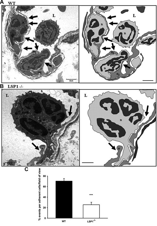 Figure 3. Electron micrographs of migrating neutrophils in WT and LSP1−/− mice. (A) WT; (B) Lsp1−/− mice. Sections (70 nm) were taken after KC superfusion (5nM) of the cremaster. Images and corresponding cartoons demonstrate endothelial dome formations (arrows) in WT mice (A) and the lack of such formations in LSP1 deficient mice (B arrow). Scale bars indicate 2 μm (A) and 1 μm (B). Image acquisition, panels A-B: Hitachi H-7000 transmission electron microscope; direct magnification: 3000× (A), 4000× (B); 16000 AMT camera, AMT Capture Engine software (V.600.128); images generated with Microsoft Office PowerPoint 2003 (SP3). Percentage quantification of the electron micrograph sections based on the adherent neutrophils per vessel that underwent transendothelial migration in WT vs Lsp1−/− animals (C). Thirty-eight to 42 vessel sections per background were analyzed. ***P < .001. Error bars indicate SEM. e1-e3 indicate endothelial cells; n, neutrophil; and L, vessel lumen.