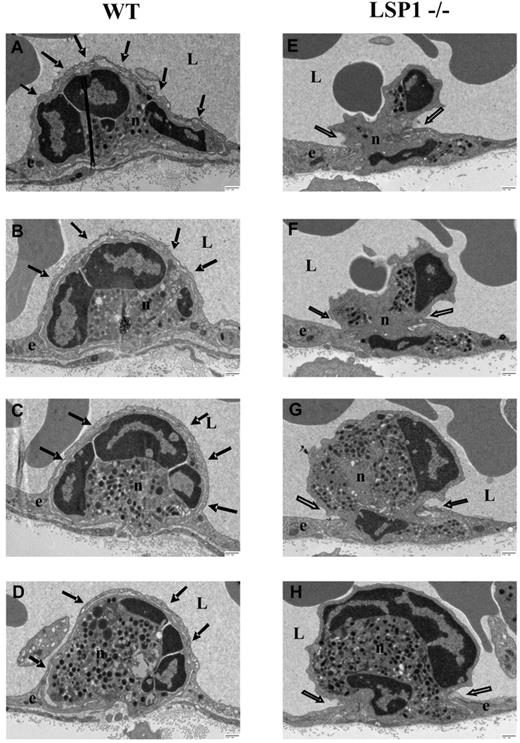 Figure 4. Serial sections from micrographs of migrating neutrophils in WT and Lsp1−/− mice. Sections were taken after KC superfusion (5nM) of the cremaster. Serial sections (each 70 nm) were cut 350 nm apart. Filled arrows demonstrate endothelial dome formations in WT mice (A-D), and open arrows point the lack of such formations in LSP1-deficient mice (E-H). Scale bar indicates 500 nm. e indicates endothelial cell; n, neutrophil; and L, vessel lumen. Image acquisition: Hitachi H-7000 transmission electron microscope; direct magnification: 6000×; 16000 AMT camera, AMT Capture Engine software (V.600.128); images generated with Microsoft Office PowerPoint 2003 (SP3).