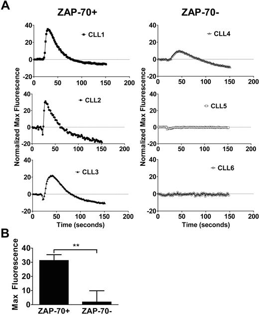 Figure 1. CXCL12 confers stronger calcium flux in ZAP-70+ CLL cells. (A) Representative calcium flux profiles of 3 ZAP-70+ (filled symbols) and 3 ZAP-70− (open symbols) CLL cells in response to 8nM CXCL12 stimulation. Measurements represent an average of triplicate data points that have been normalized to buffer controls. (B) The maximal fluorescence signal from the calcium flux was averaged between the ZAP-70+ (n = 3) and ZAP-70− (n = 3) CLL cells and was found to be significantly different on the basis of unpaired Student t test (P < .01). Data shown are median ± SD.