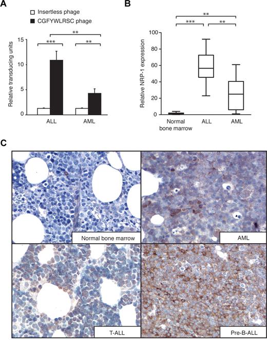 Figure 5. NRP-1 expression in leukemia bone marrow samples. (A) Binding of peptide-displaying phage or insertless control phage to bone marrow specimens of AML and ALL patients. **P < .01; ***P < .001. (B) Immunohistochemical staining for NRP-1 on ALL, AML, and normal bone marrow specimens. The amount of positively stained cells in the specimen represents the approximate levels of NRP-1 expression. *P < .05; **P < .01; ***P < .001. (C) Representative examples of immunohistochemical staining of NRP-1 (brown) on AML, T-cell ALL, and pre-B–cell ALL and normal bone marrow specimens are shown. Magnification, 500×.