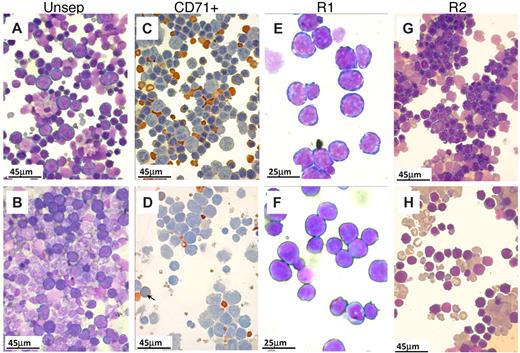 Figure 3. Morphologic appearance of erythroid cells in spleen after PHZ. (A-B,E-H) May-Grünwald-Giemsa stain. (C-D) Benzidine/hematoxylin stain. (A) Smears from control spleens at day 4 after PHZ treatment. Note the predominant presence of erythroid cells. Nonerythroid cells were 34% plus or minus 4%; n = 7. (B) In β1Δ/Δ spleens, proportionally fewer erythroid cells were present (from 20%–30%; nonerythroid cells were 78 ± 3%, n = 3) and of less mature stage (mostly at the proerythroblastic stage). (C) CD71+ cells (purified by CD71 magnetic column selection). In control spleens, erythroid cells at several maturation stages predominate. (D) CD71+ cells from β1Δ/Δ spleens are represented mainly by early stages of erythroid cells with fewer more mature erythroid cells (shown by arrows). (E) Smears from R1 (CD7hi/TER119lo) cells sorted by FACS. (F) R1 cells from β1Δ/Δ. (G) Smears from R2 cells (CD7hi/TER119hi) sorted from normal spleens at day 4 after PHZ. Populations of erythroblasts at intermediate maturation stages predominate. (H) Smears of R2-sorted cells from β1Δ/Δ spleens at day 4 after PHZ. Fewer later erythroblasts and many large reticulocytes are present. Smears were made using a Shandon cytospin and, after staining, were mounted with distilled water. Photographs were taken at room temperature using a Nikon Coolpix 995 digital camera mounted to the ocular of an Olympus BHT-2 microscope. Magnification bars are inserted. Distilled water was used to mount the cytospins. Images were uploaded into a computer, and Adobe Photoshop was used to correct brightness and contrast.
