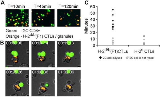 Figure 3. CTL stopping, lengthy conjugate duration and sustained granule polarization precede death of the recognizing cell. Lysis of recognizing T cells by targeted CTLs as demonstrated by live cell video microscopy. Target H-2d/b (F1) CTLs were loaded with LysoTracker Red, which accumulates in granules (orange in appearance), and added to calcein-loaded 2C CD8+ T cells (green). Cells were then subject to live video microscopy with a Deltavision Restoration microscope (Applied Precision Instruments) using a MicroMax 5 MHz cooled CCD camera (Roper Scientific). Image sequences of the time-lapse recording were processed with SoftWoRx (Applied Precision). (A) Wide field microscopy demonstrating killing of recognizing T cells. F1 CTLs and 2C CD8+ cells were stained as described. After 2 hours of incubation, marked depletion of the recognizing 2C CD8+ cells was observed. (B) Snapshots depict the sequence of events occurring in the targeted CTL, culminating in lysis of the recognizing T cell. Time elapsed from the beginning of stable cell-cell contact is indicated. Top row: the CTL shifts its granules toward the contact area. Bottom row: sequential lysis of the 2 2C cells may be observed. Scale bar = 10μm. (C) The effect of specific recognition of CTL on conjugate duration and lysis. Calcein-loaded 2C CD8+ T cells were placed in culture with target H-2d/b CTLs or with unrecognizable H-2s CTLs and were then monitored by video microscopy. The durations of CTL-2C contacts were recorded and plotted. Data shown were acquired from several microscopic fields and are from a single experiment representative of 3 experiments.