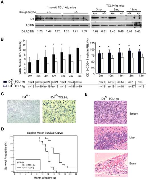 Figure 4. Haploid loss of ID4 in Eμ-TCL1-tg mice leads to accelerated CLL disease progression. (A) ID4 protein expression in CD19+-selected B cells from Eμ-TCL1-tg mice without (+/+) or with (+/−) haploid loss of ID4. Numbers at the bottom give the relative amounts of ID4 protein. (B) Left: WBC counts from blood smears obtained from mice aged from 2 to 8 months. Right: 100 μL of peripheral blood lymphocytes (PBL) were collected each month and measured by flow cytometry for the percentage of CD19+CD5+ cells in mice aged from 9 to 13 months. Bottom: Number of live animals from each group that was available and analyzed. *Indicates statistically significant differences based on 2-sample t tests. (C) Representative blood smear stained with Wright-Giemsa showing an increased number of circulating lymphocytes in Eμ-TCL1-tg mice with haploid loss of ID4 (age, 14 months), but not in age-matched control heterozygous ID4 mice. (D) Kaplan-Meier survival curves from F1 littermates of Eμ-TCL1-tg mice with or without the haploid loss of ID4. (E) Histologic immunophenotyping of spleen, liver, and brain from Eμ-TCL1 mice with haploid loss of ID4. Top: Obliterative lymphoma is present in the periarteriolar lymphoid sheaths (white pulp) of spleen. Middle: Evidence of lymphocyte infiltration is suggested in approximately 25% of the liver sections by intrasinusoidal neoplastic cells. Bottom: Marked hippocampal neuronal necrosis was observed in the section from brain, as well as moderate multifocal cerebral, cerebellar, and meningeal hemorrhage, indicating the infiltration of malignant lymphocytes in the brain.