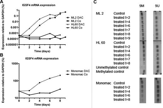 Figure 5. relative expression and promoter methylation of IGSF4 in cell lines after culture with decitabine. Graph showing IGSF4 mRNA expression in cell lines ML-2, HL-60, and MONO-MAC-1 at different time points during culture with demethylating agent decitabine (DAC). (A) Solid lines correspond to untreated conditions of cell lines ML-2 (t(6;11)) and HL-60 (AML-other), and dotted lines reflect values from treated conditions of the same cell lines. Shown is > 1000-fold up-regulation of IGSF4 expression during culture with decitabine, whereas in control conditions expression remained stable. (B) Treatment of cell line MONO-MAC-1 with decitabine. The solid line reflects values from untreated condition, and the dotted line from corresponding treated samples. A 10-fold up-regulation was found during a treatment period of 8 days. (C) Results for MS-PCR in cell lines cultured with demethylating agent decitabine for 2-9 days. Left column, results for 9M primers; right column, for 9U primers. Under control conditions ML-2 and HL-60 mainly show a methylated promoter region. Shortly after start of treatment unmethylated bands are visible, and methylated bands decrease in intensity. MONO-MAC-1 shows both bands at the start of the experiment, and the methylated band clearly weakens during treatment.