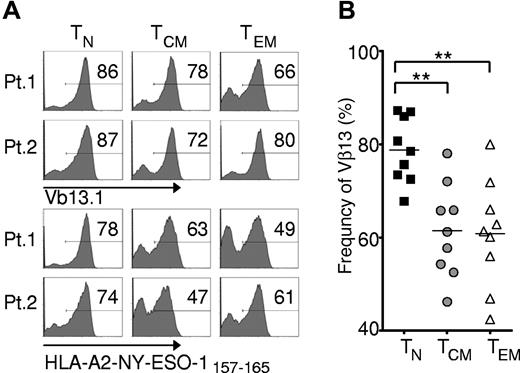 Figure 2. Effector cells derived from naive rather than memory precursors express the genetically engineered TCR with greater frequency. Cryopreserved leukapheresis samples were thawed and rested overnight. CD8+ T-cell subsets were isolated then stimulated with allogeneic feeders, anti-CD3, and IL-2. Cells were transduced to express the 1G4-α-95:LY mutant TCR 48 hours after stimulation, and flow cytometric analysis was performed 10-16 days after stimulation. (A) Expression of Vβ13.1 (the 1G4 β-chain clonotype) and binding to HLA-A2-NY-ESO-1157-165 tetramer by transduced cells from 2 representative patients. Gate frequencies are displayed. (B) Frequency of Vβ13.1+ cells following transduction of samples from 9 patients (**P < .001).