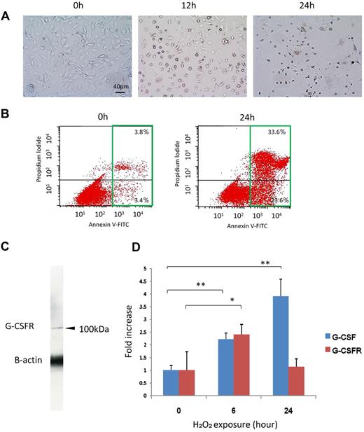 Figure 1. H2O2 induced apoptosis and increased G-CSF and G-CSFR expression in HRECs. (A) Representative images of H2O2-induced apoptosis in HREC culture. Note that the number of apoptotic cells increased with time. h indicates hours after exposure to H2O2. (B) The number of apoptotic cells was measured by fluorescence-activated cell sorter using annexin V antibody. Increases in the number of annexin V-positive cells at 24 hours (green square) were observed. Note that numbers of both the early apoptotic cells (bottom right quadrant) and the late apoptotic or necrotic cells (top right quadrant) were increased by H2O2. (C) G-CSFR expression on HRECs was confirmed by Western blot analysis. (D) The effect of oxidative stress on G-CSFR or G-CSF mRNA expression in HRECs. Expression of G-CSF mRNA was significantly increased over time by oxidative stress (n = 4 at each point). **P < .01. Increased G-CSFR mRNA expression was observed at 6 hours after 1mM H2O2 exposure (n = 4 at each point), and the level was returned to normal at 24 hours. *P < .05.