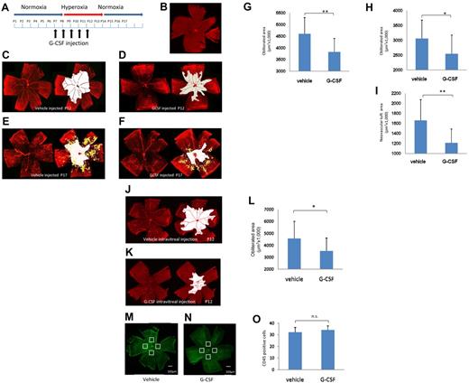 Figure 3. G-CSF rescued the vascular change in the OIR model. (A) Time scheme of the experiments. G-CSF (50 μg/kg) was administered intraperitoneally daily between P6 and P10. (B-F) Retinal whole mounts stained with collagen IV antibody to detect the area with retinal vasculature. (B-C) Control P7 and P12, respectively. Note the nonvascular area (white) in the P12 retina that was not observed in the P7 retina. Vascular obliteration occurred between P7 and P12 in this model. (D) A G-CSF–treated P12 retina. The area of vascular obliteration (white) was decreased by G-CSF. (E-F) At P17, neovascular tufts (yellow) and vascular attenuation (white) were marked in the control OIR retina (E), and G-CSF reduced both changes (F). (G) G-CSF injection reduced the obliteration area at P12 compared with the control (n = 13 each group). **P < .01. (H-I) G-CSF reduced both the vascular obliterated area and the neovascular tuft at P17 compared with the controls (n = 13 in each group). *P < .05. **P < .01. (J-L) Intravitreal injection of G-CSF (P6) also reduced the vascular attenuation (white) in the OIR model. (J) Control treated retina at P12. (K) G-CSF-treated retina at P12. Intravitreal G-CSF injection reduced the obliteration area significantly to that of control (n = 5 each group). *P < .05. (M-O) Vehicle-treated (M) and G-CSF–treated (N) OIR retina, stained with CD45 antibody, and counted the CD45+ cells at 4 points of 300 μm2 in the avascular area at P12. No remarkable difference in the number of CD45+ cells. (O) n = 4 each group. P > .05.