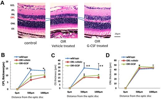 Figure 5. G-CSF attenuates OPL thinning in OIR retinas. (A) Left panel: untreated control mouse retina; middle panel: G-CSF–treated mouse retina; right panel: vehicle-treated mouse retina. (B-D) Quantitative analysis. G-CSF–treated mice had thicker OPL than did vehicle-treated mice (n = 8 in each group). *P < .05. **P < .01. OIR mice had thinner OS than control mice. **P < .01. The OS thickness did not change by treatment (C). Outer nuclear layer (ONL) of OIR was same as control mice (D).
