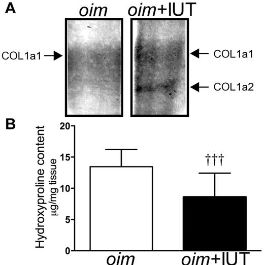 Figure 1. oim+IUT bones showed the presence of Col1a2 protein expressed by the donor cells. (A) Coomassie stain showing the presence of Col1a2 band in oim+IUT femurs. (B) Hydroxyproline content in oim and oim+IUT mice. †††P < .001 (Mann-Whitney test).