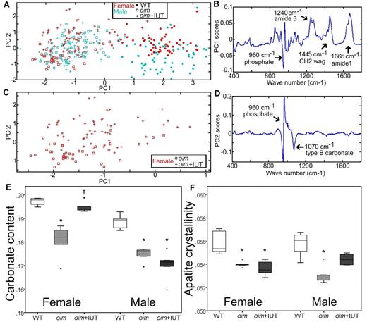 Figure 2. Raman spectroscopy analysis of the cortical bone tissue of WT, oim, and oim+IUT mice. (A) PC1 versus PC2 obtained demonstrates that PC1 differentiates WT from oim and oim+IUT. (B) Weighting of spectrum frequencies contributing to PC1. (C) Subset of data from panel A showing that female oim and oim+IUT are differentiated by PC2. (D) Weighting of spectrum frequencies contributing to PC2. (E) Carbonate content. (F) Apatite crystallinity obtained by univariate peak analysis of the Raman spectra. *P < .05 (significant difference vs WT group). †P < .05 (significant difference vs oim group).